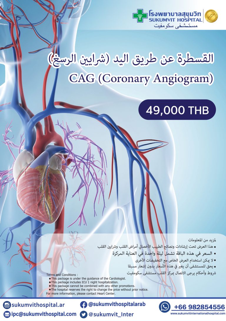 CAG (Coronary Angiogram)